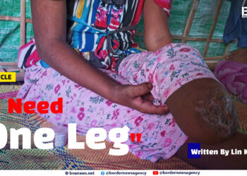 “I Need One Leg”