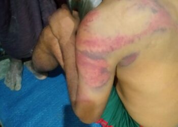 Rohingya Refugees Targeted by Kidnappers While Seeking Livelihoods Outside Camps