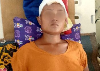 Injured Civilian Dies After Brutal Junta Airstrike on Mrauk-U