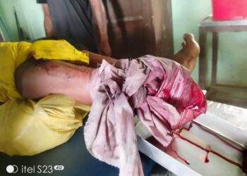Mro Youth Severely Injured, Loses Right Leg After Landmine Blast in Maungdaw