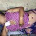Woman Injured in Kyauktaw Airstrike Dies