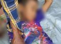 Child Loses Four Fingers in Landmine Explosion in Thandwe